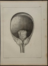 1839 - Planche d'anatomie & urologie - Luette vésicale et prostate - Litho