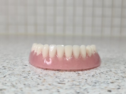 Prothèse inférieure