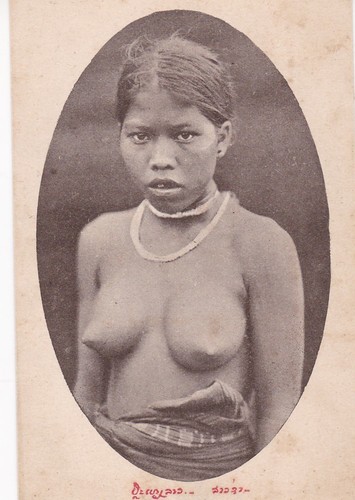 Laos femme kha seins - femme,