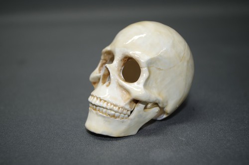 Hartzinn tête mort - hartzinn,
