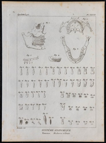 1825 crâne humain et dents - crâne,