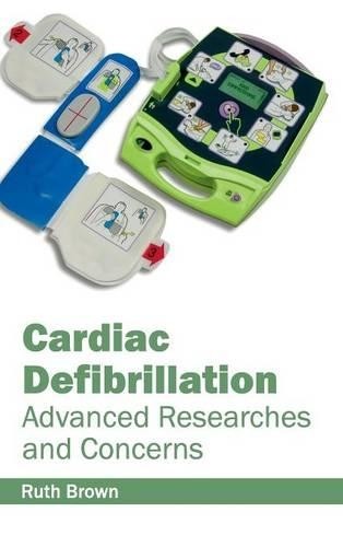 Cardiac defibrillation - cardiac,