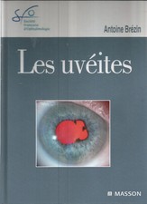 LES UVEITES