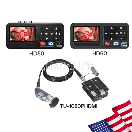 1080p full endoscopy - hd,