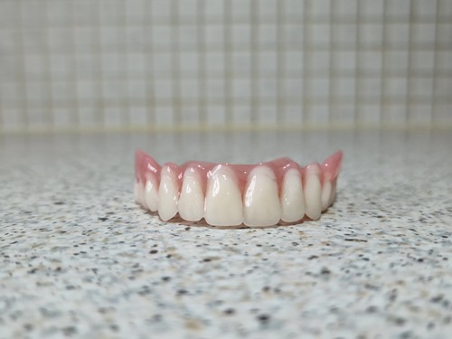 Dentier supérieur