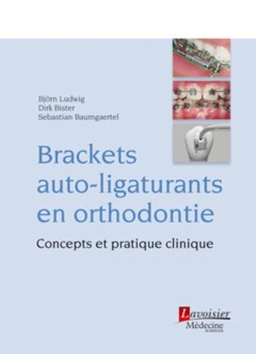 Brackets auto ligaturants - brackets, auto-ligaturants