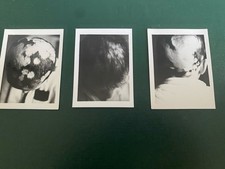 Triptyque De Photos D’un Crâne Humain Vers 1950 Évoque Francis Bacon Ou Autres