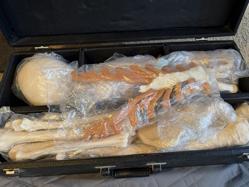 Somso disarticulated unmounted - somso,