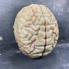 Moulage de cerveau humain en
