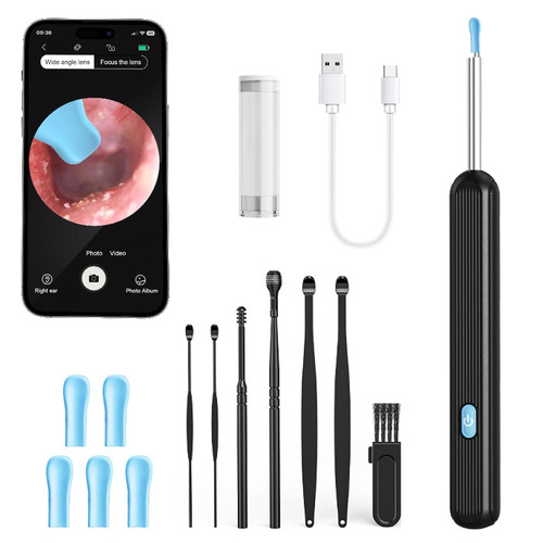 Otoscope oreille 1080p hd - otoscope, oreille,