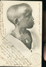 ORAN NEG.. DE TOMBOUCTOU DEFEORMATION DU CRANE