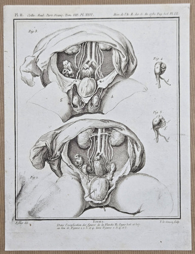 Gravure xixeme planche - gravure,