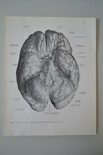 PLANCHE D'ANATOMIE HUMAINE SYSTEME NERVEUX CERVEAU ATLAS Dr SOBOTTA MEDECINE