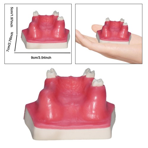 Modèle implant dentaire - modèle,