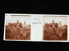 HOMME HIDROCELE MALADE PLAQUE VERRE 45x107 VUE STEREOSCOPIQUE VERASCOPE RICHARD